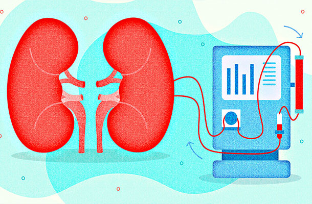 sarıyer istanbul diyaliz merkezi - Hemodiyaliz Nedir ?